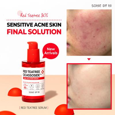 Tinh chất làm dịu da nhạy cảm, da mụn SOMEBYMI RED TEATREE CICASSOSIDE FINAL SOLUTION SERUM 50ML